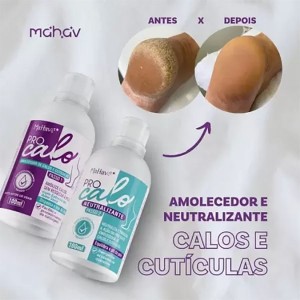 Kit 12 Kit Pro Calo Amolecedor de Calos e Cutículas c/ 2 Etapas 100 ml